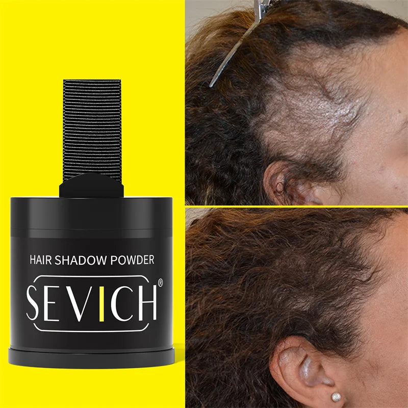 Sevich Hairline Shadow Powder | Root Touch-Up Coverage 10g