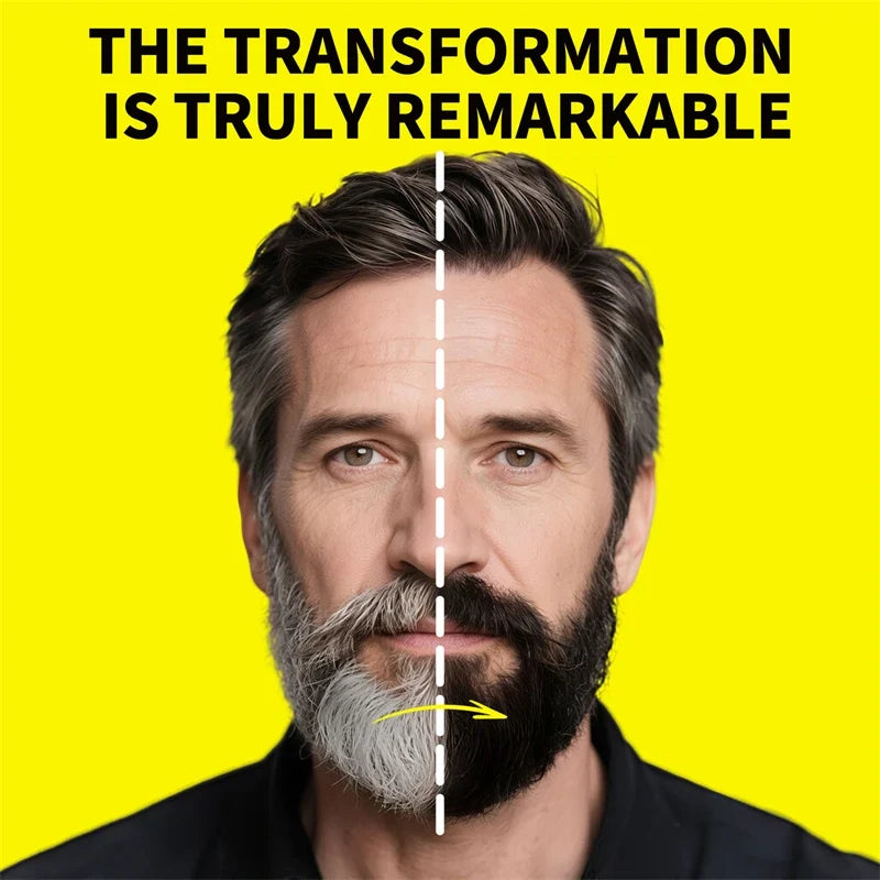 Sevich Black Beard Dye Shampoo – Natural Temporary Color for Men