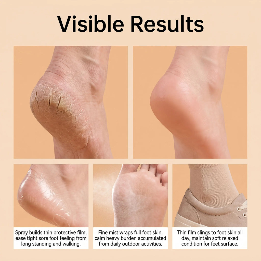 Bee Venom Foot Barrier Spray – 24H Anti-Friction Mist | 20ml