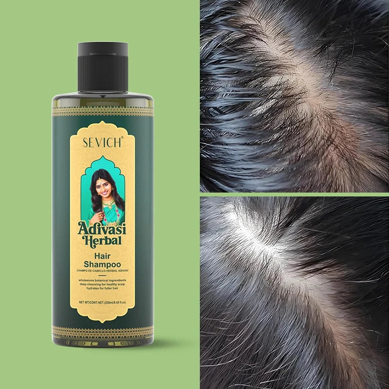 Sevich Rosemary Hair Growth Oil Set – Herbal Shampoo & Serum