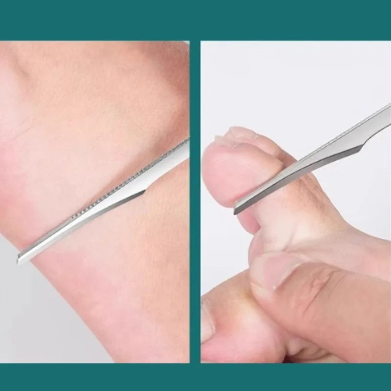 2pcs Double-Sided Foot Callus File & Dead Skin Scraper Set