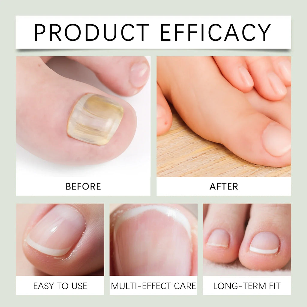 South Moon Oregano & Tea Tree Nail Care Oil 30ml