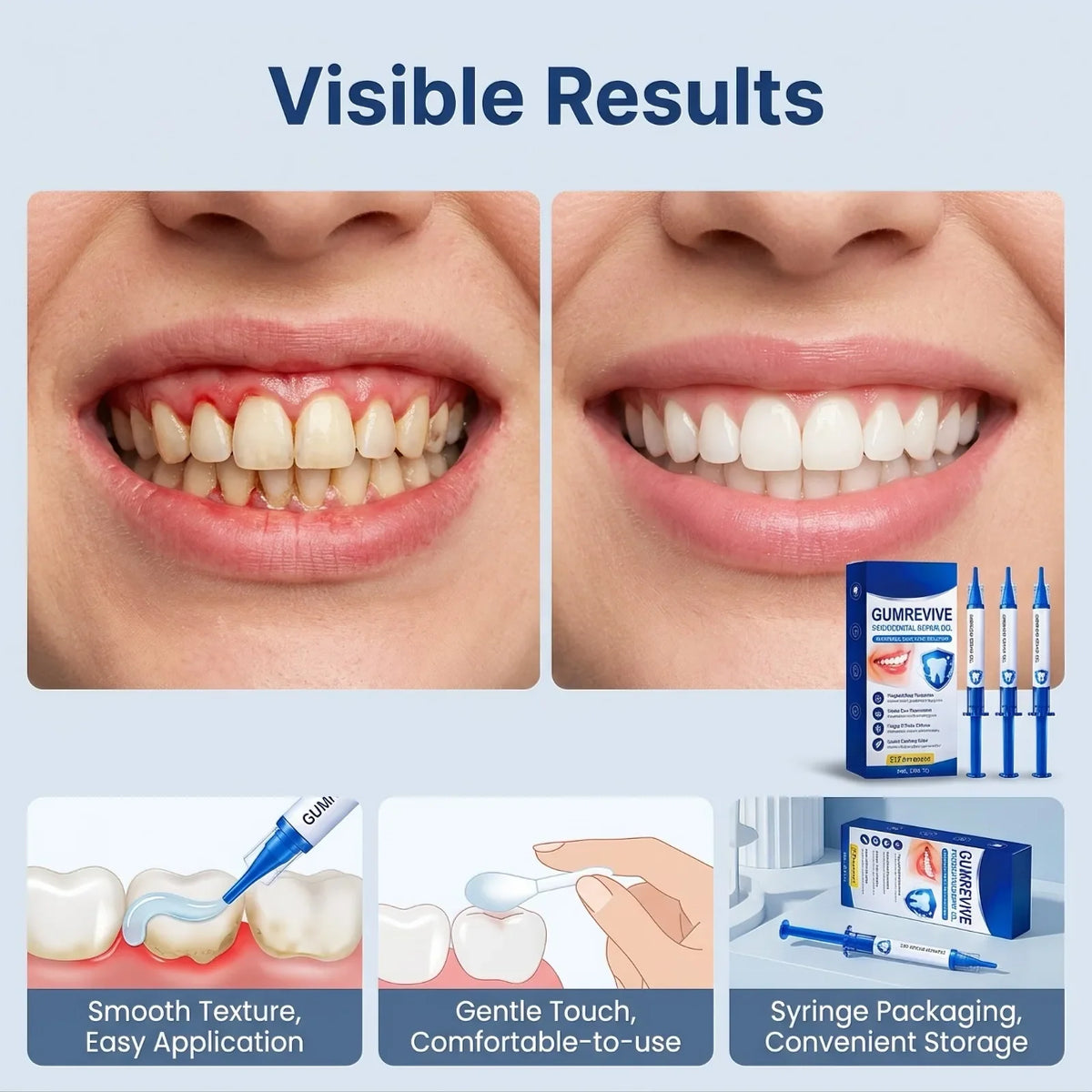 Gum Repair Gel – Plaque Removal, Whitening & Gum Care