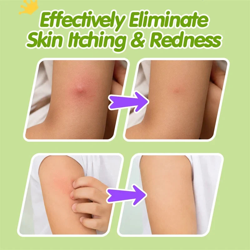 Kids Cooling Soothing Balm 6g – Mosquito Bite Skin Care