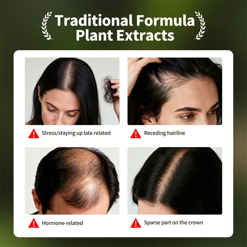 Sevich Hair Growth Serum Set – Usman Oil, Shampoo & Soap