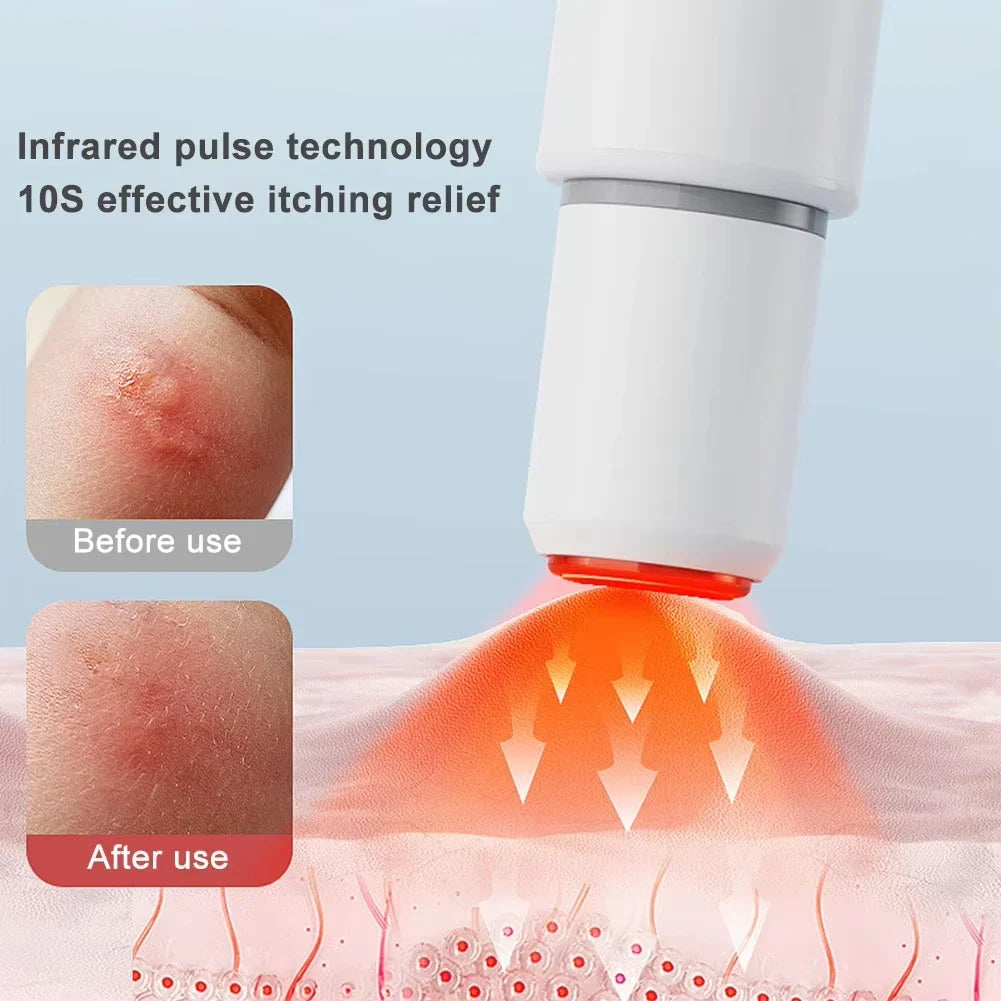 NOCCLILI Electronic Insect Bite Pen | Portable Anti-Itch Device