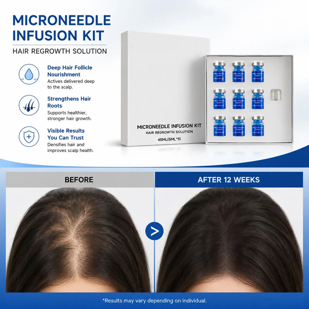 Microneedle Scalp Serum Kit – Nourishing Hair Care Set 45ml