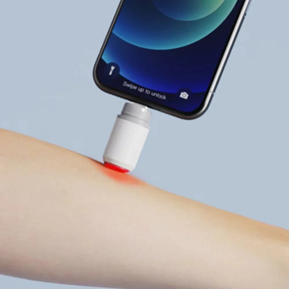 NOCCLILI Electronic Insect Bite Pen | Portable Anti-Itch Device