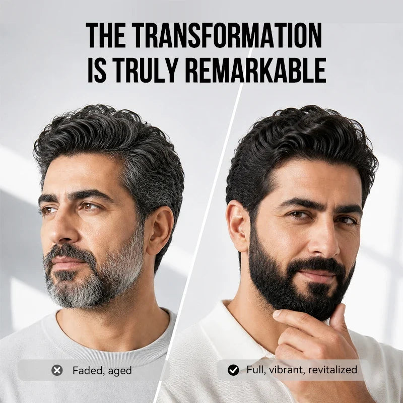 Sevich Black Beard Dye Shampoo – 5-Min Color for Men