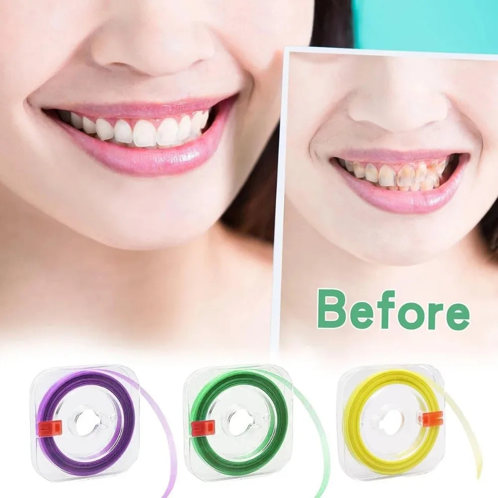 Dental Polishing Strips – Interdental Sanding & Finishing