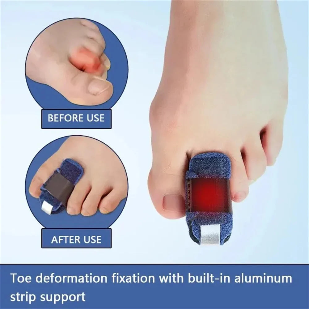 Toe Splint Straightener – Hammer Toe Brace & Support Wrap