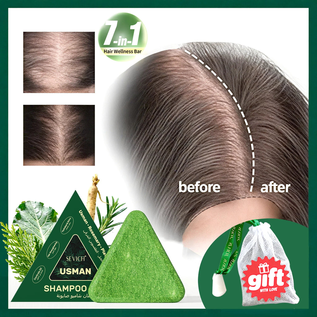 Sevich Hair Growth Serum Set – Usman Oil, Shampoo & Soap