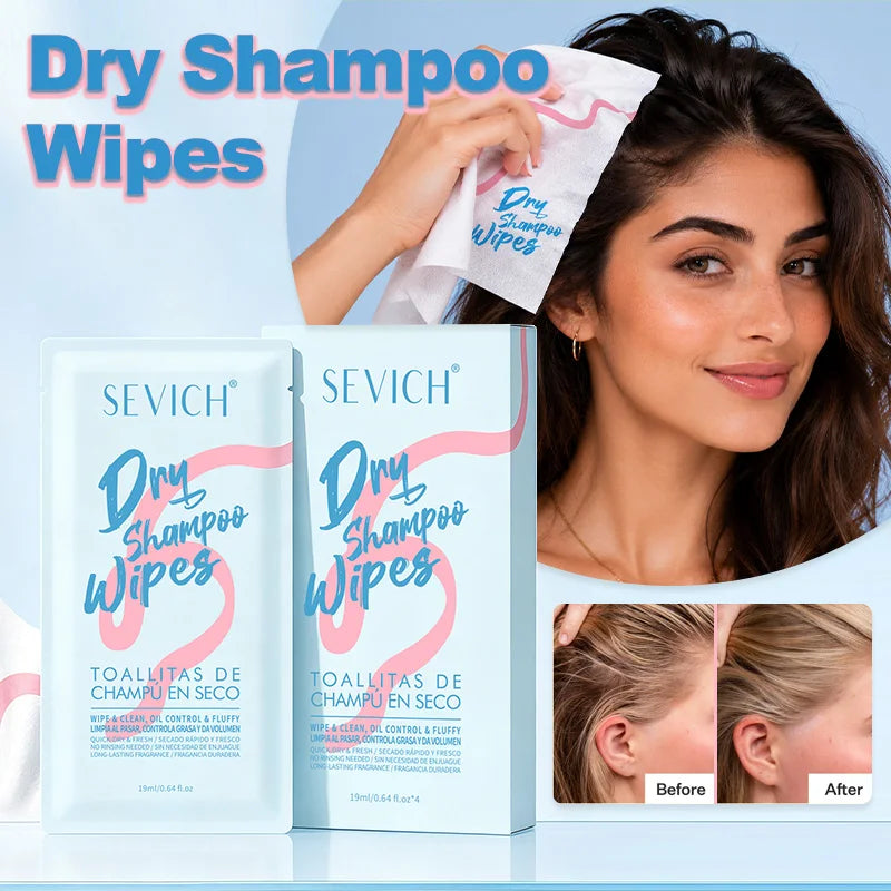 Sevich Dry Shampoo Wipes – No-Rinse Oil Control | 4 Pack