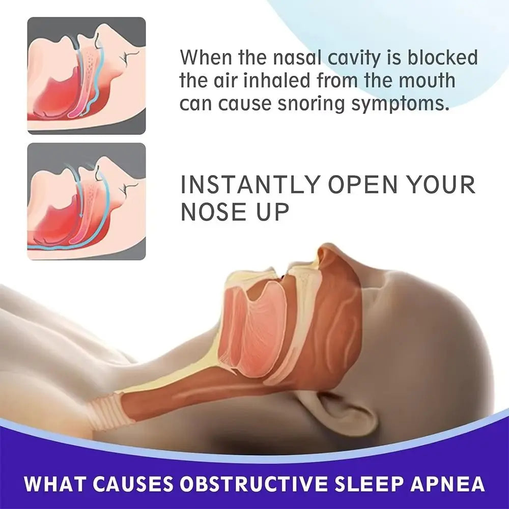 Hypoallergenic Nasal Strips for Better Sleep | 10 or 30 Pcs